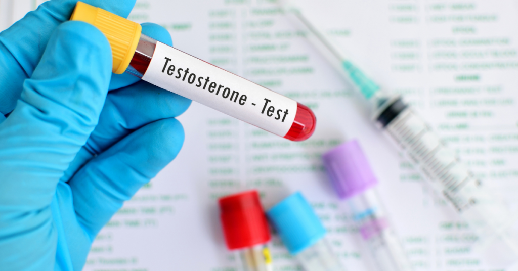 Testosterone Levels At Different Stages of Life