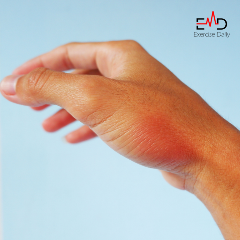 can cellulitis kill you