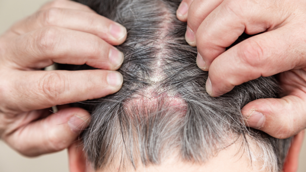 Why Do My Hair Follicles Hurt?
