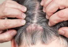 why do my hair follicles hurt