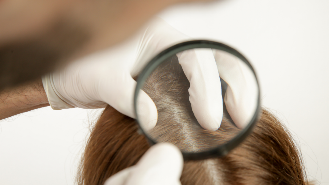 Why Do My Hair Follicles Hurt?