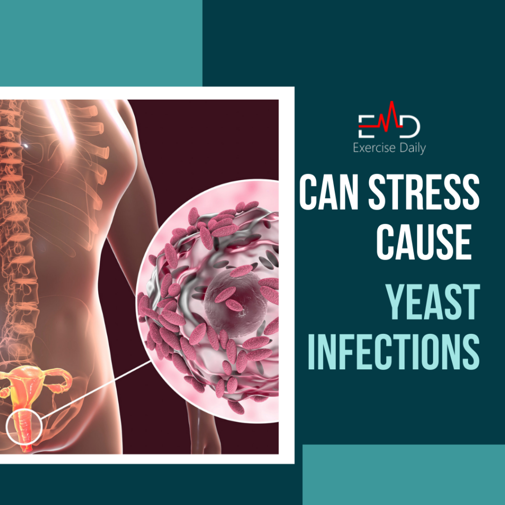 can-stress-cause-yeast-infections