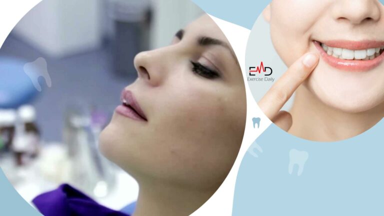 How long should you wait to Exercise after Tooth Extraction?