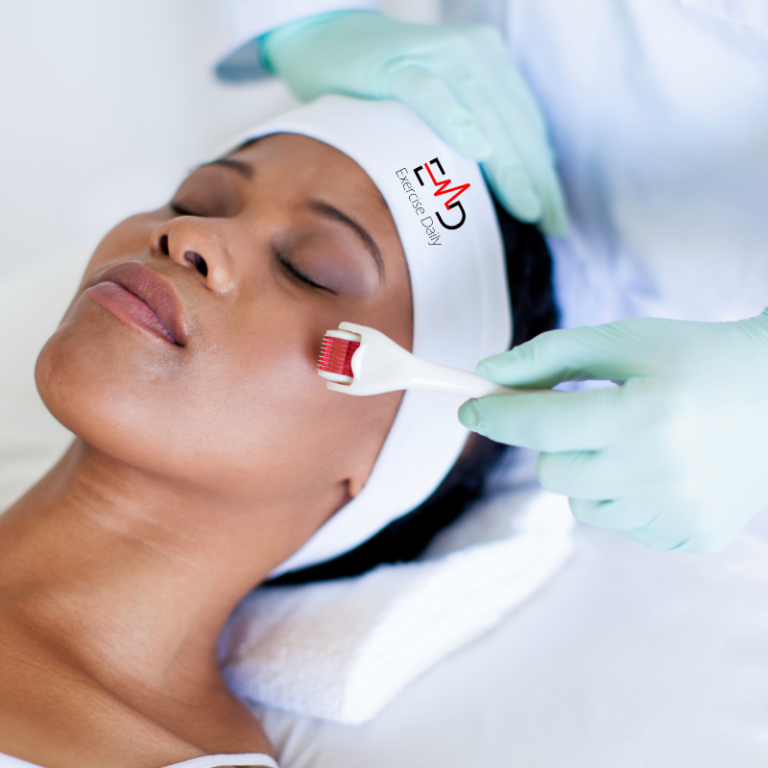 How-Often-Should-You-Get-Micro-Needling