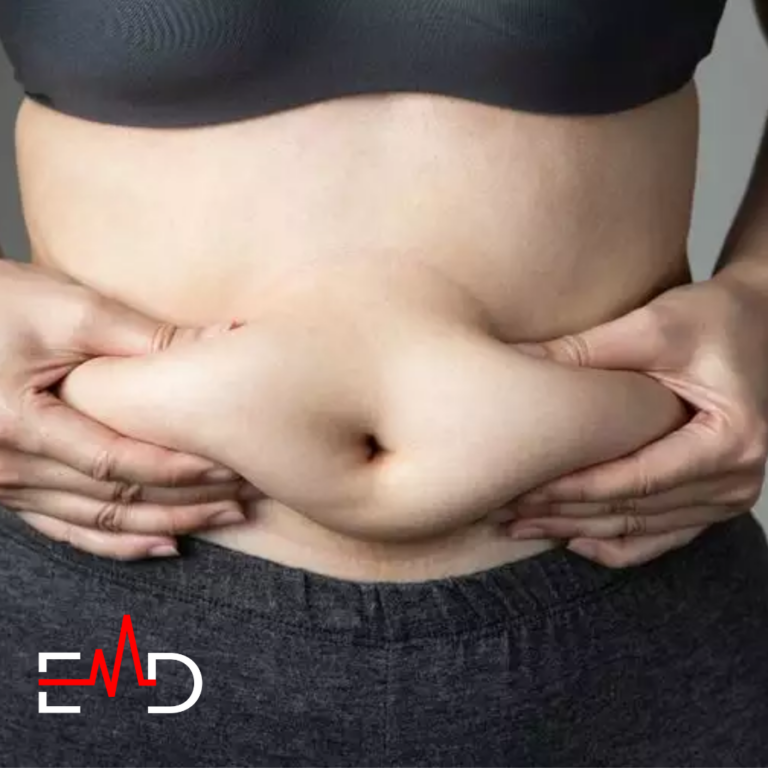 5 Best Exercises to Get Rid of Belly Overhang 5 Best Exercises to Get Rid of Belly Overhang