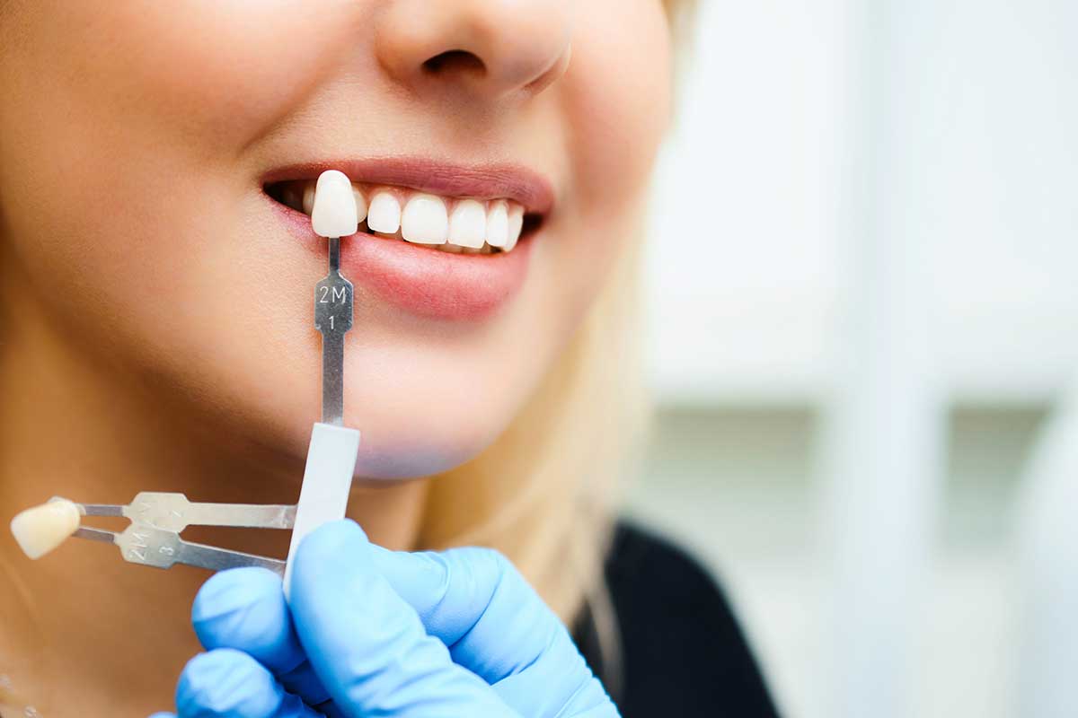 Best Dental Implants in Mexico: A Cost-Effective Option for a Beautiful Smile