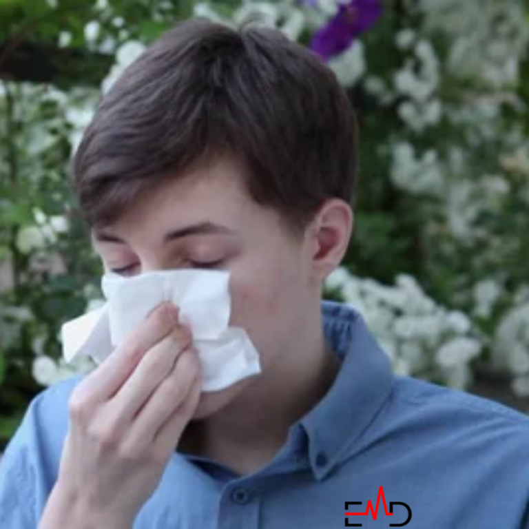 20 Effective Alleviate Allergies with Natural Remedies