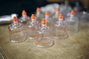 Affordable Acupuncture And Traditional Chinese Medicine In Sunnyvale – Exercise Daily